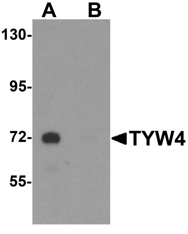 Western blot analysis of TYW4 in rat brain tissue lysate with TYW4 antibody at 1 ug/ml in (A) the absence and (B) the presence of blocking peptide.