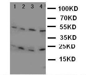 WB of LCN1 antibody. Lane 1: JURKAT Cell Lysate. Lane 2: COLO320 Cell Lysate. Lane 3: SCG Cell Lysate. Lane 4: HELA Cell Lysate.