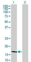 Western Blot analysis of LCN1 expression in transfected 293T cell line by LCN1 monoclonal antibody (M02), clone 1B11.Lane 1: LCN1 transfected lysate(19.25 KDa).Lane 2: Non-transfected lysate.