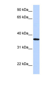 LCN12 antibody LS-C102788 Western blot of Fetal Heart lysate.