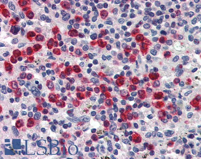 Anti-LCN2 antibody IHC of human spleen. Immunohistochemistry of formalin-fixed, paraffin-embedded tissue after heat-induced antigen retrieval. Antibody LS-B2496 concentration 5 ug/ml.