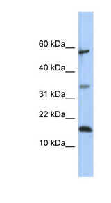 LCN6 antibody LS-C102378 Western blot of 721_B cell lysate.