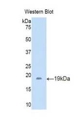 Western blot of recombinant LCN6.