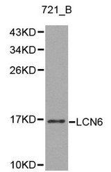 Western blot of LCN6 pAb in extracts from 721_B cells.