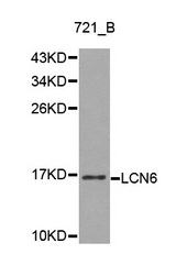 Western blot analysis of 721_B cell lysate using LCN6 antibody.