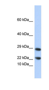 LCN8 antibody LS-C112202 Western blot of 721_B cell lysate.