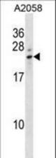 LCN8 Antibody western blot of A2058 cell line lysates (35 ug/lane). The LCN8 antibody detected the LCN8 protein (arrow).