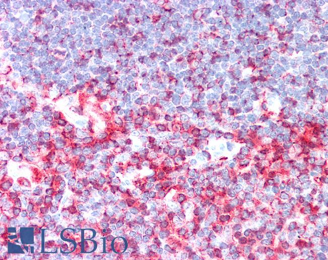 Anti-LCP1 / L-Plastin antibody IHC staining of human thymus. Immunohistochemistry of formalin-fixed, paraffin-embedded tissue after heat-induced antigen retrieval.