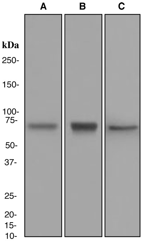 Western blot analysis on (A) THP-1, (B) Jurkat, and (C) K562 cell lysates using anti-Plastin L antibody.