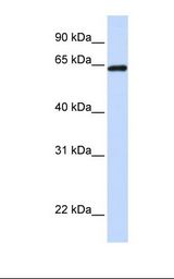 Placenta lysate. Antibody concentration: 1.0 ug/ml. Gel concentration: 12%.