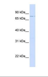 MCF7 cell lysate. Antibody concentration: 1.0 ug/ml. Gel concentration: 12%.