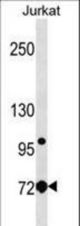 LCP1 Antibody western blot of Jurkat cell line lysates (35 ug/lane). The LCP1 antibody detected the LCP1 protein (arrow).