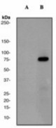 Western blot analysis on Jurkat cell lysates using anti-Phospho-SLP-76 (pY145) antibody (LS-C105379), 1:200000 dilution. Cells were either (A) untreated (B) treated with pervanadate.