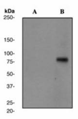 Western blot analysis on Jurkat cell lysates using anti-Phospho-SLP-76 (pY113) antibody (LS-C105348), 1:10000 dilution. Cells were either (A) untreated (B) treated with pervanadate.