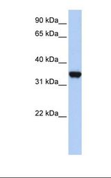293T cell lysate. Antibody concentration: 1.0 ug/ml. Gel concentration: 12%.