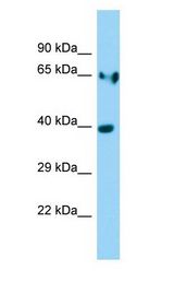 LDHA / LDH A antibody Western Blot of Rat Stomach.
