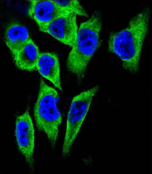 Confocal immunofluorescent of LDHA Antibody with A375 cell followed by Alexa Fluor 488-conjugated goat anti-rabbit lgG (green). DAPI was used to stain the cell nuclear (blue).
