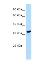 LDHAL6A antibody LS-C146071 Western blot of HepG2 Cell lysate. Antibody concentration 1 ug/ml.