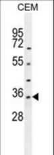 LDHAL6A Antibody western blot of CEM cell line lysates (35 ug/lane). The LDHAL6A antibody detected the LDHAL6A protein (arrow).