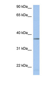 LDHAL6B antibody LS-C111545 Western blot of Fetal Kidney lysate.