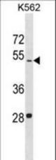 LDHAL6B Antibody western blot of K562 cell line lysates (35 ug/lane). The LDHAL6B antibody detected the LDHAL6B protein (arrow).