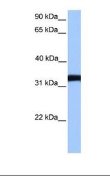 NTERA2 cell lysate. Antibody concentration: 1.0 ug/ml. Gel concentration: 12%.