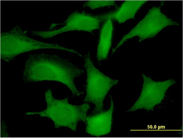 Immunofluorescence of monoclonal antibody to LDHC on HeLa cell . [antibody concentration 10 ug/ml]
