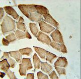 LDHD Antibody immunohistochemistry of formalin-fixed and paraffin-embedded human skeletal muscle followed by peroxidase-conjugated secondary antibody and DAB staining.