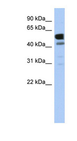 LDHD antibody LS-C111487 Western blot of Fetal Heart lysate.