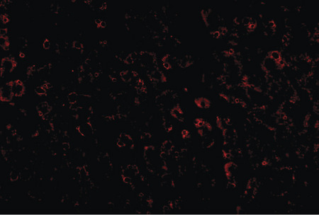 Immunofluorescence of LDLR in human liver tissue with LDLR antibody at 20 ug/ml.