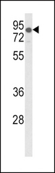 Western blot of LDLR Antibody in mouse lung tissue lysates (35 ug/lane). LDLR (arrow) was detected using the purified antibody.