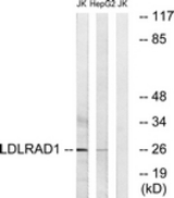Western blot of extracts from Jurkat/HepG2 cells, using LDLRAD1 Antibody. The lane on the right is treated with the synthesized peptide.