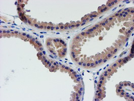 IHC of paraffin-embedded Human breast tissue using anti-LECT2 mouse monoclonal antibody.