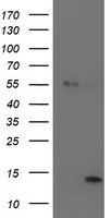 HEK293T cells were transfected with the pCMV6-ENTRY control (Left lane) or pCMV6-ENTRY LECT2 (Right lane) cDNA for 48 hrs and lysed. Equivalent amounts of cell lysates (5 ug per lane) were separated by SDS-PAGE and immunoblotted with anti-LECT2.