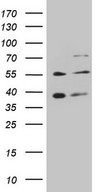 HEK293T cells were transfected with the pCMV6-ENTRY control (Left lane) or pCMV6-ENTRY GRK4 (Right lane) cDNA for 48 hrs and lysed. Equivalent amounts of cell lysates (5 ug per lane) were separated by SDS-PAGE and immunoblotted with anti-GRK4.