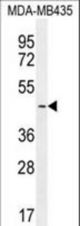 LEF1 Antibody western blot of MDA-MB435 cell line lysates (35 ug/lane). The LEF1 antibody detected the LEF1 protein (arrow).