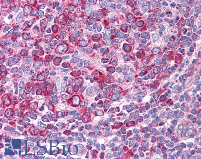 Anti-LEF1 antibody IHC of human tonsil. Immunohistochemistry of formalin-fixed, paraffin-embedded tissue after heat-induced antigen retrieval. Antibody LS-B984 concentration 5 ug/ml.