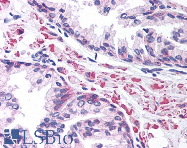 Anti-LEF1 antibody IHC of human prostate. Immunohistochemistry of formalin-fixed, paraffin-embedded tissue after heat-induced antigen retrieval. Antibody LS-B984 concentration 5 ug/ml.