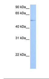 Jurkat cell lysate. Antibody concentration: 1.0 ug/ml. Gel concentration: 12%.