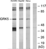 Western blot of extracts from HeLa/HepG2/HUVEC cells, using GRK5 Antibody. The lane on the right is treated with the synthesized peptide.