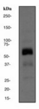 Western blot analysis on Human placenta cell lysate using anti-GRK5 antibody (LS-C105308), dilution 1:500.