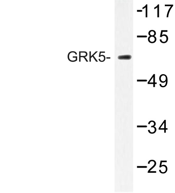 Western blot of GRK5 (Q382) pAb in extracts from HeLa cells.