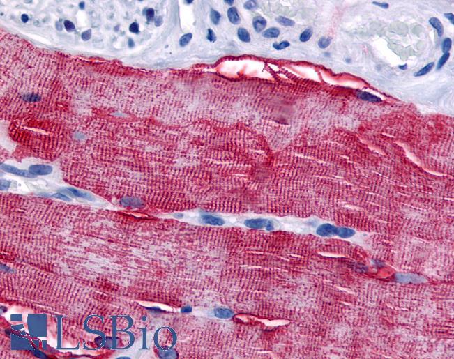 Anti-GRK5 antibody LS-A3034 IHC of human skeletal muscle. Immunohistochemistry of formalin-fixed, paraffin-embedded tissue after heat-induced antigen retrieval.