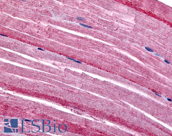 Anti-GRK5 antibody LS-A3470 IHC of human myocytes. Immunohistochemistry of formalin-fixed, paraffin-embedded tissue after heat-induced antigen retrieval.