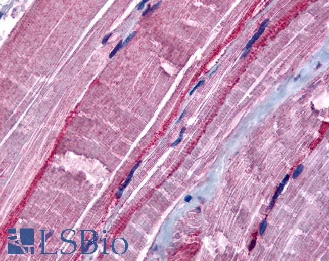 Anti-GRK5 antibody LS-A3400 IHC of human skeletal muscle. Immunohistochemistry of formalin-fixed, paraffin-embedded tissue after heat-induced antigen retrieval.