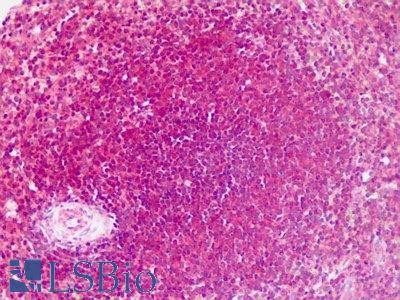 Human Spleen: Formalin-Fixed, Paraffin-Embedded (FFPE)