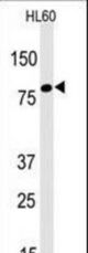 Western blot of anti-Leo1 Antibody in HL60 cell line lysates (35 ug/lane). Leo1(arrow) was detected using the purified antibody.