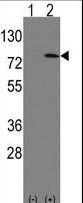 Western blot of Leo1 (arrow) using rabbit polyclonal Leo1 Antibody (Human N-term). 293 cell lysates (2 ug/lane) either nontransfected (Lane 1) or transiently transfected with the Leo1 gene (Lane 2) (Origene Technologies).