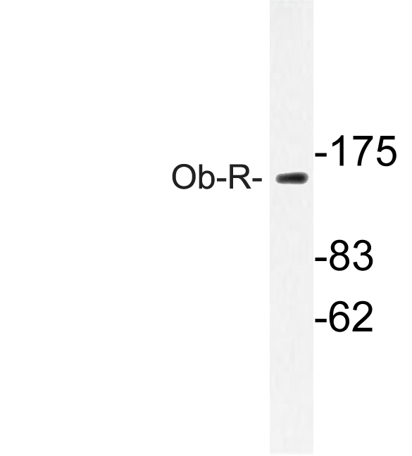 Western blot of Ob-R (L662) pAb in extracts from COLO cells.