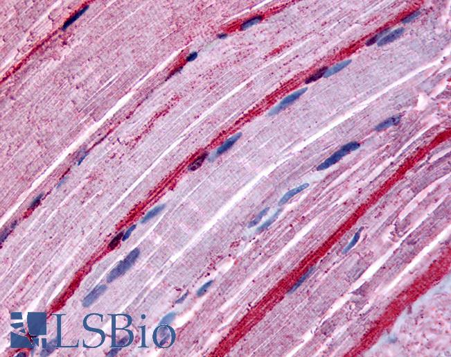 Anti-GRK5 antibody LS-A3030 IHC of human skeletal muscle. Immunohistochemistry of formalin-fixed, paraffin-embedded tissue after heat-induced antigen retrieval.